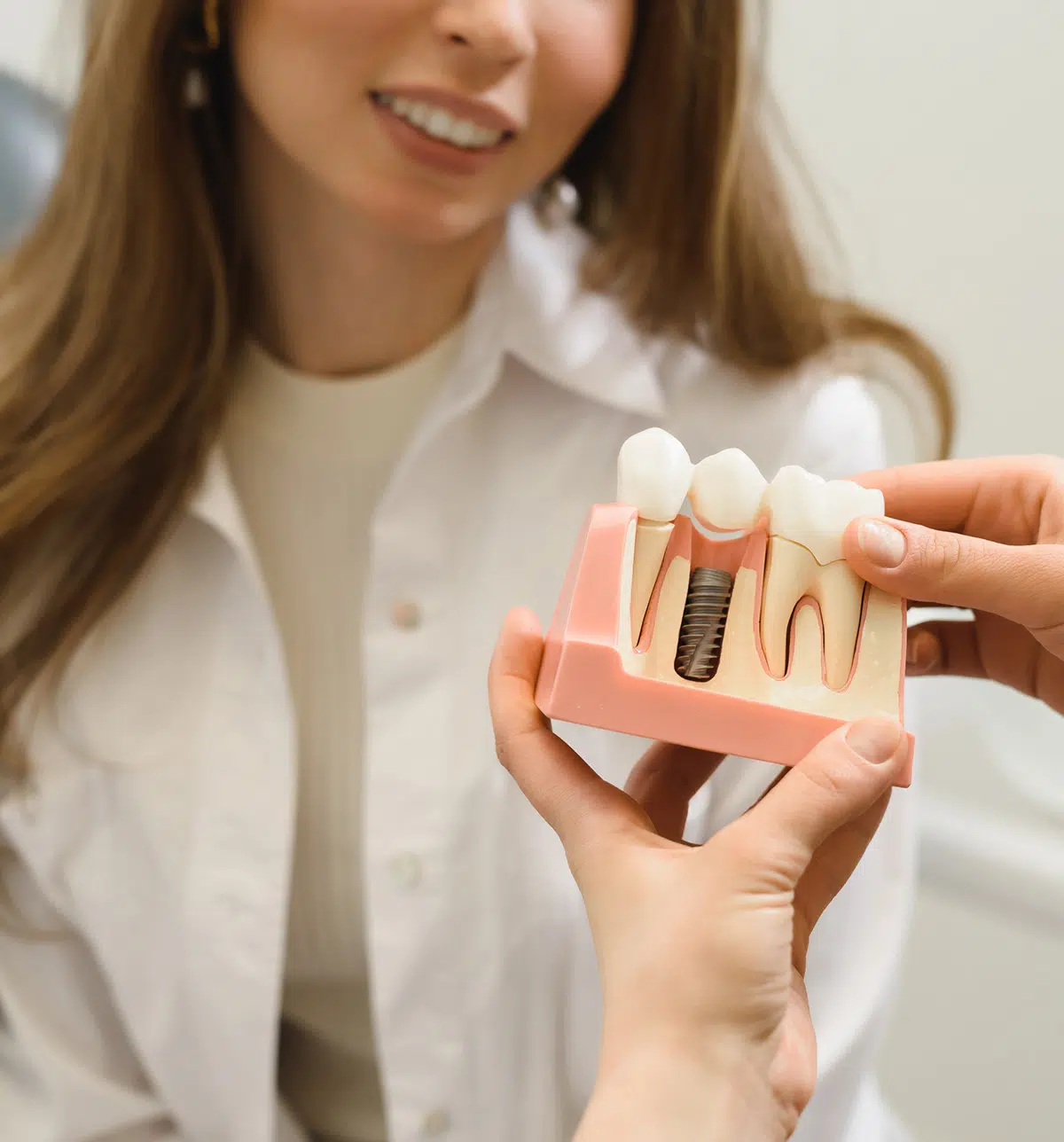 Beautiful-Replacement Teeth Dental Implant in Chandler, AZ | Smiles of Chandler