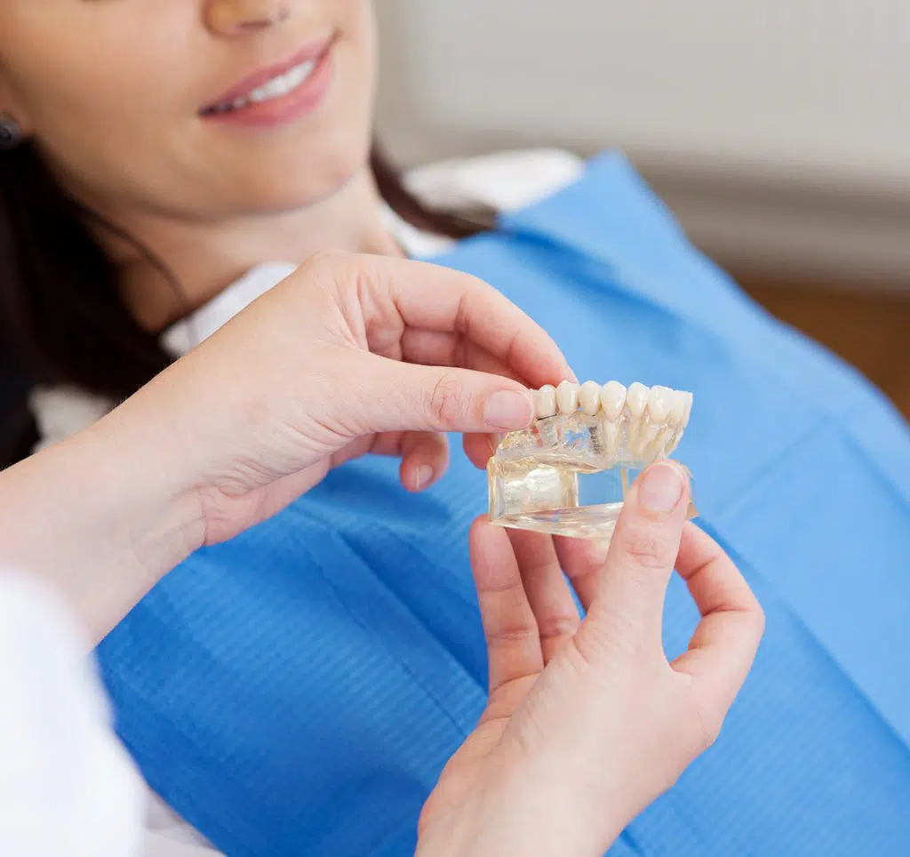 Dental Veneers Vs Dental Crown: Option is Better? | Smiles Of Chandler in Chandler, AZ