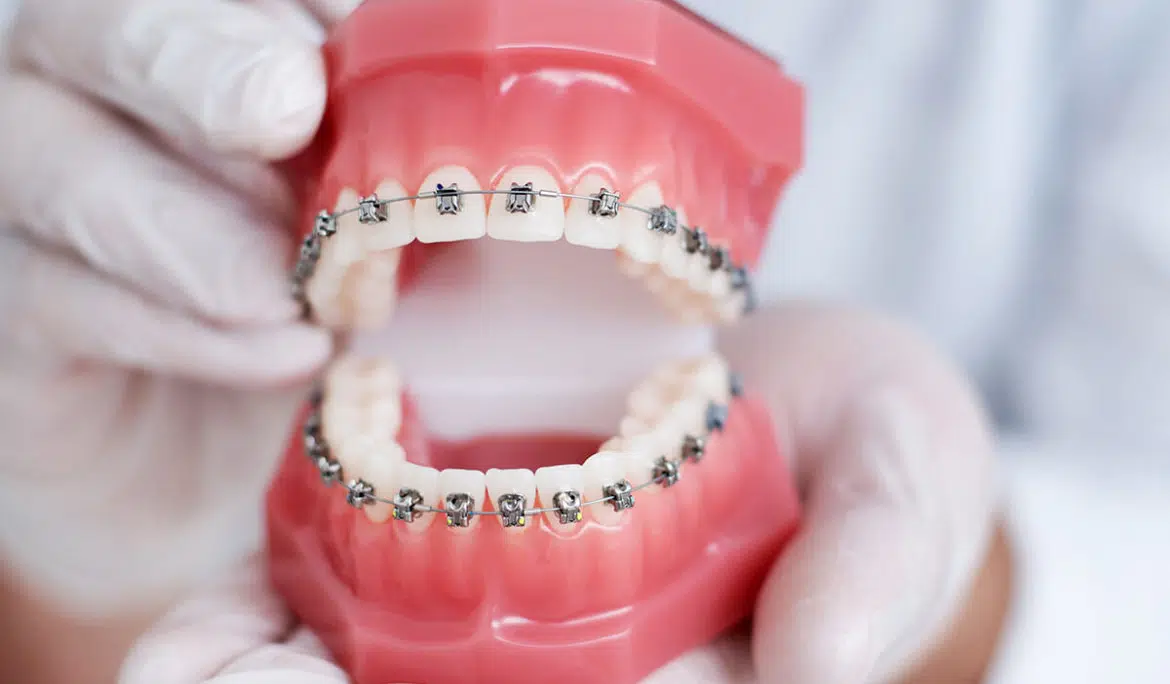 Dentist showing Dummy teeth in Chandler, AZ | Smiles of Chandler