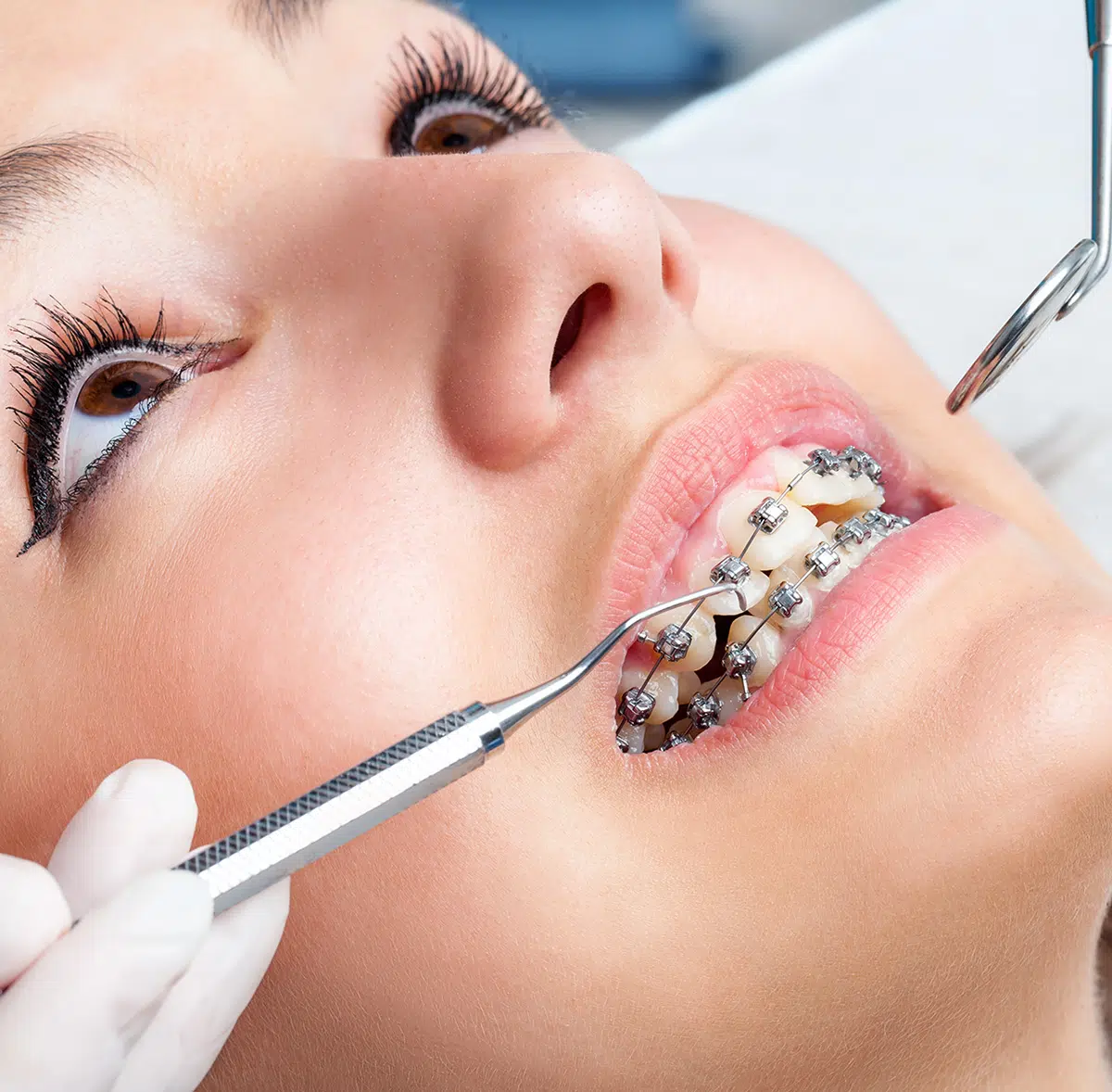 Dentist checking female dental braces in Chandler, AZ | Smiles of Chandler