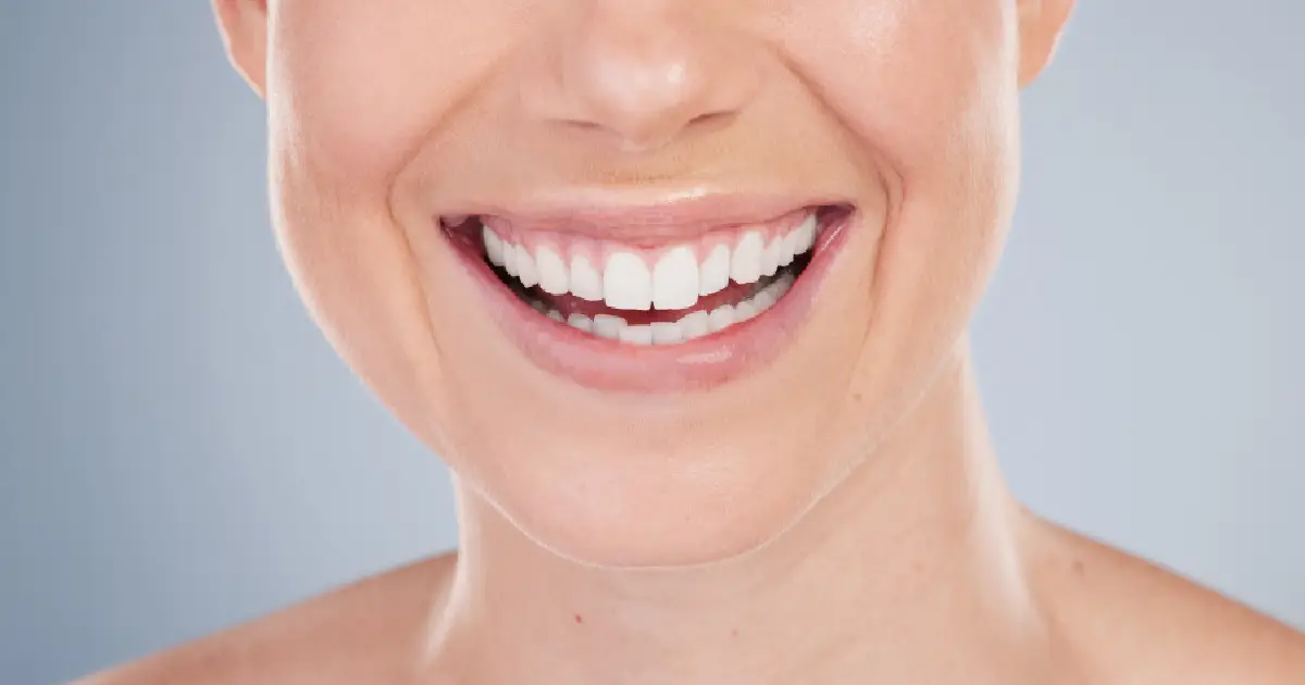 Zoom Teeth Whitening by Smiles of Chandler in Arizona