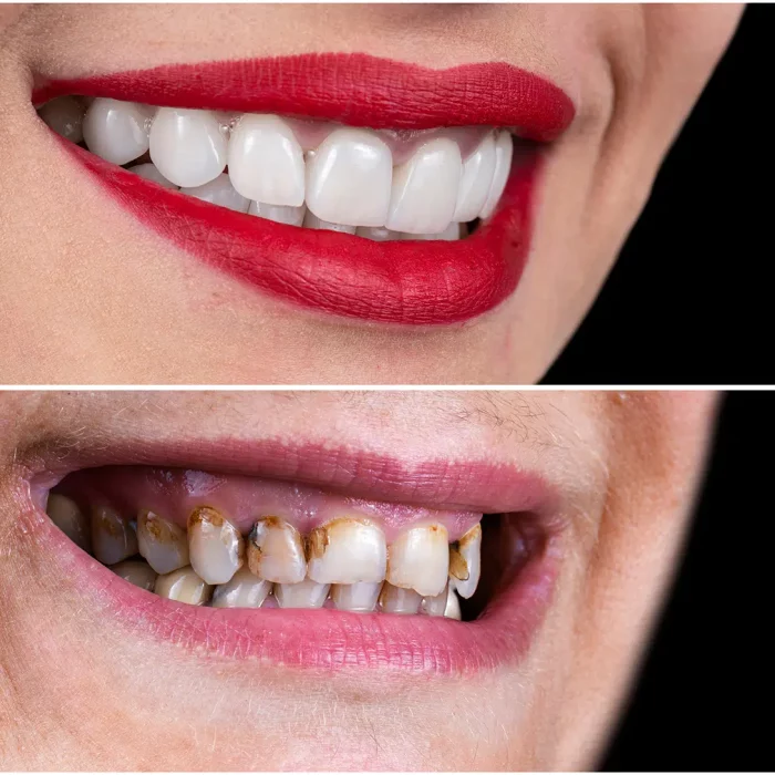 Dental Treatment Before and After Photos | Smiles of Chandler in Chandler, AZ