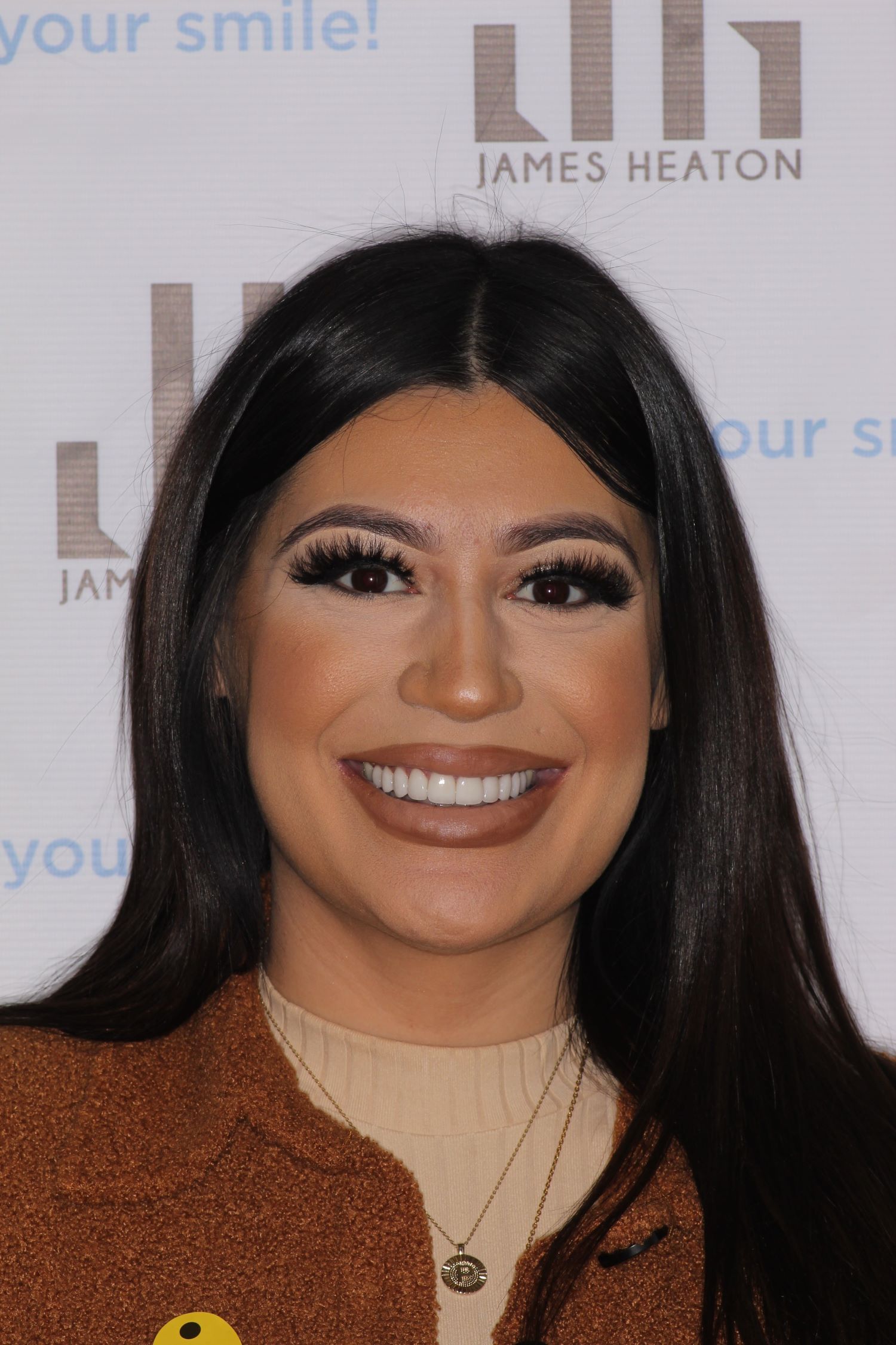 Priscilla full face after in Chandler, AZ