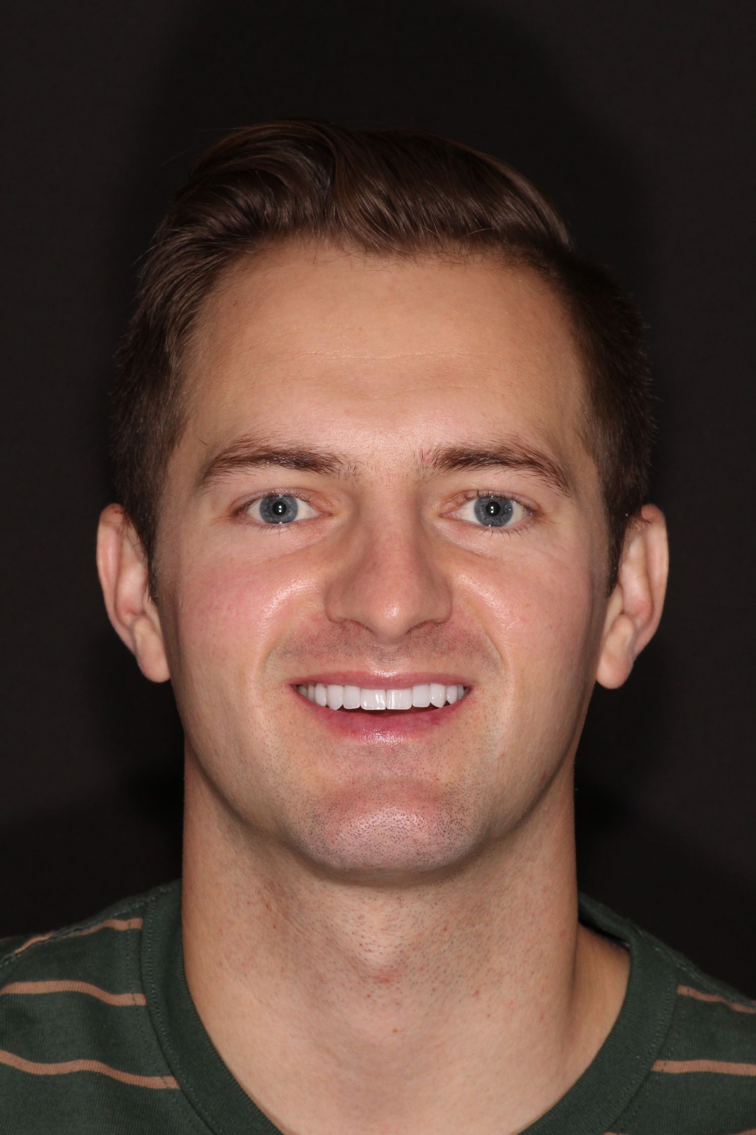 Justin full face after in Chandler, AZ