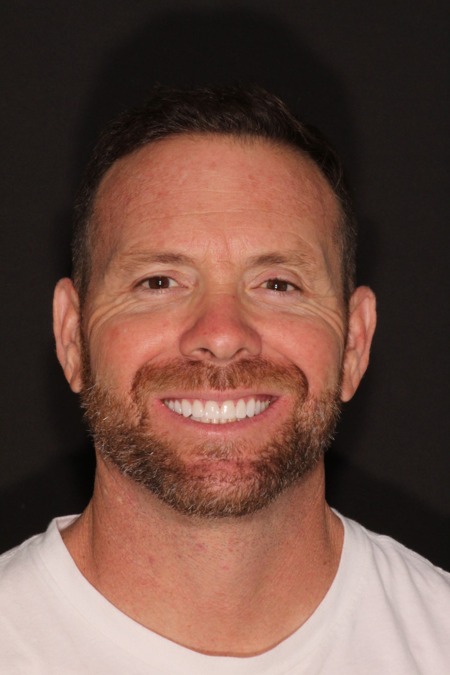 Mike full face after in Chandler, AZ
